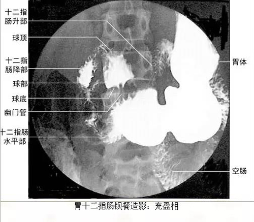 微信图片_20191220141440.jpg