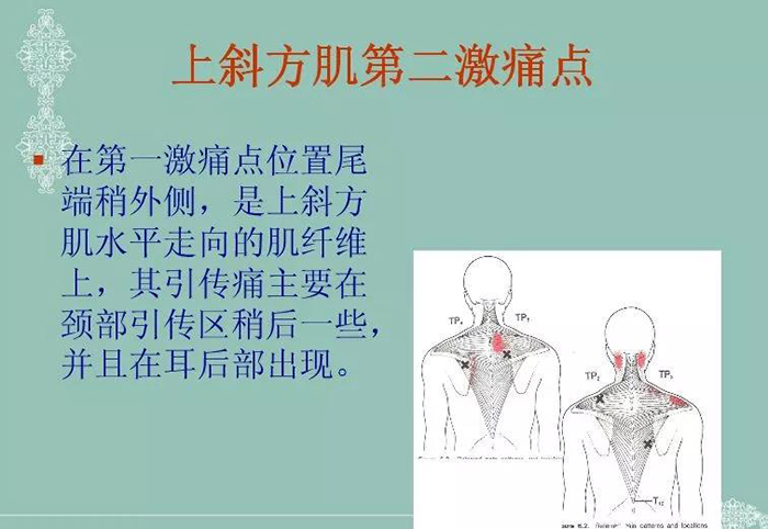 斜方肌的定位触诊与肌痛点常见问题处理 - 疼痛天地