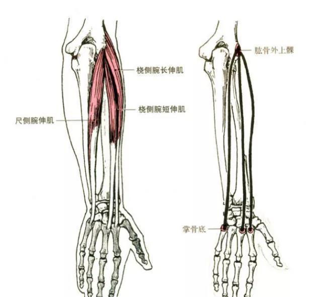 20,桡侧腕长伸肌 起点:肱骨外上髁. 止点:第二掌骨底.